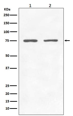 Anti-GARS Rabbit Monoclonal Antibody Boster Bio