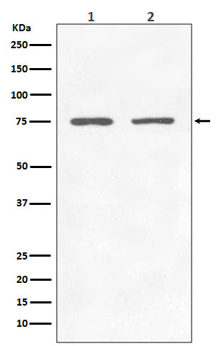 Anti-GARS Rabbit Monoclonal Antibody Boster Bio