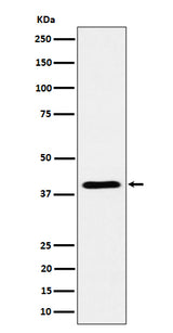 Anti-ADH4 Rabbit Monoclonal Antibody Boster Bio