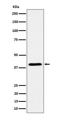 Anti-ADH4 Rabbit Monoclonal Antibody Boster Bio