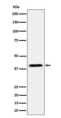 Anti-ADH4 Rabbit Monoclonal Antibody Boster Bio