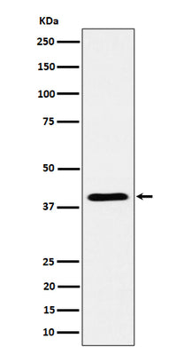 Anti-ADH4 Rabbit Monoclonal Antibody Boster Bio