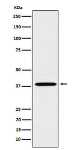 Anti-LTB4R Rabbit Monoclonal Antibody Boster Bio