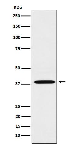 Anti-LTB4R Rabbit Monoclonal Antibody Boster Bio