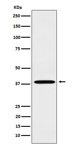 Anti-LTB4R Rabbit Monoclonal Antibody Boster Bio