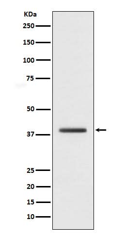 Anti-macroH2A.1 H2AFY Monoclonal Antibody Boster Bio