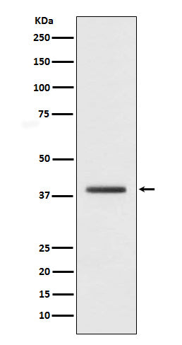 Anti-macroH2A.1 H2AFY Monoclonal Antibody Boster Bio
