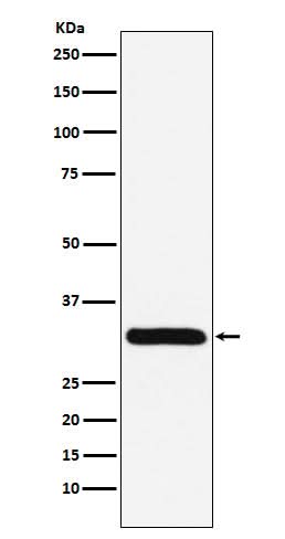 Anti-PSME1 Rabbit Monoclonal Antibody Boster Bio