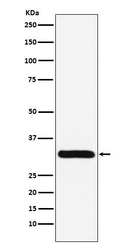 Anti-PSME1 Rabbit Monoclonal Antibody Boster Bio