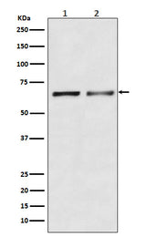 Anti-Activin Receptor Type IIB/ACVR2B Rabbit Monoclonal Antibody Boster Bio