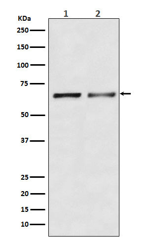 Anti-Activin Receptor Type IIB/ACVR2B Rabbit Monoclonal Antibody Boster Bio