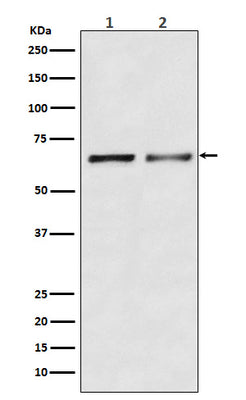 Anti-Activin Receptor Type IIB/ACVR2B Rabbit Monoclonal Antibody Boster Bio