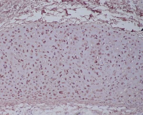 Anti-Aggrecan Rabbit Monoclonal Antibody Boster Bio