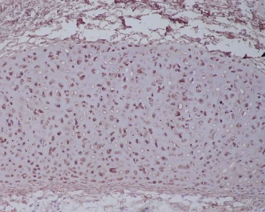 Anti-Aggrecan Rabbit Monoclonal Antibody Boster Bio