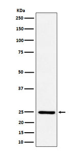 Anti-Ephrin A1 Rabbit Monoclonal Antibody Boster Bio