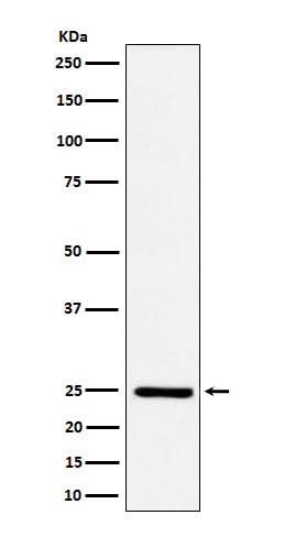Anti-Ephrin A1 Rabbit Monoclonal Antibody Boster Bio