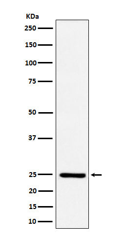 Anti-Ephrin A1 Rabbit Monoclonal Antibody Boster Bio