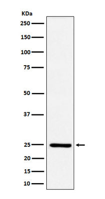 Anti-Ephrin A1 Rabbit Monoclonal Antibody Boster Bio
