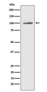 Anti-ATP2A1/SERCA1 Rabbit Monoclonal Antibody Boster Bio