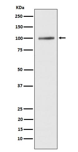 Anti-ATP2A1/SERCA1 Rabbit Monoclonal Antibody Boster Bio