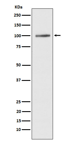 Anti-ATP2A1/SERCA1 Rabbit Monoclonal Antibody Boster Bio