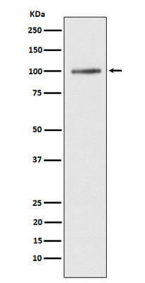 Anti-ATP2A1/SERCA1 Rabbit Monoclonal Antibody Boster Bio