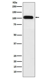Anti-SERCA1 ATPase Rabbit Monoclonal Antibody Boster Bio