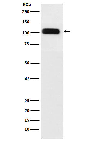 Anti-SERCA1 ATPase Rabbit Monoclonal Antibody Boster Bio