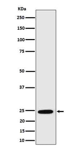 Anti-RalA Rabbit Monoclonal Antibody Boster Bio
