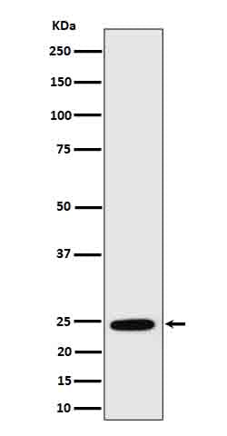 Anti-RalA Rabbit Monoclonal Antibody Boster Bio