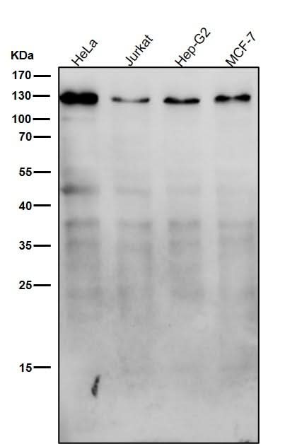 Anti-Meckelin Rabbit Monoclonal Antibody Boster Bio