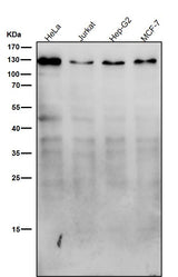Anti-Meckelin Rabbit Monoclonal Antibody Boster Bio
