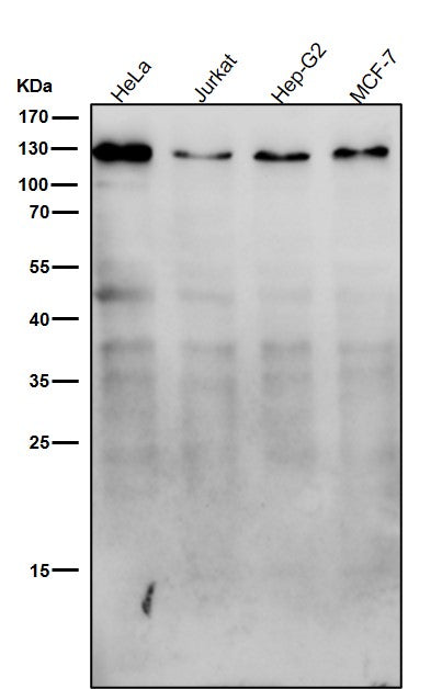 Anti-Meckelin Rabbit Monoclonal Antibody Boster Bio