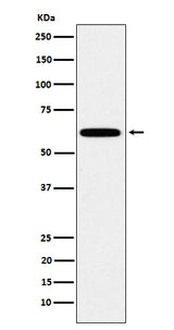 Anti-HSF2 Rabbit Monoclonal Antibody Boster Bio