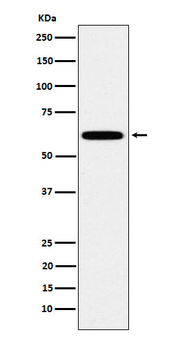 Anti-HSF2 Rabbit Monoclonal Antibody Boster Bio