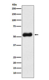 Anti-Thromboxane synthase Rabbit Monoclonal Antibody Boster Bio