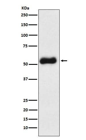 Anti-Thromboxane synthase Rabbit Monoclonal Antibody Boster Bio