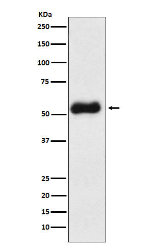 Anti-Thromboxane synthase Rabbit Monoclonal Antibody Boster Bio