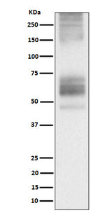 Anti-Somatostatin Receptor 1 Rabbit Monoclonal Antibody Boster Bio
