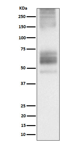 Anti-Somatostatin Receptor 1 Rabbit Monoclonal Antibody Boster Bio
