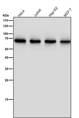 Anti-ENT2 Rabbit Monoclonal Antibody Boster Bio