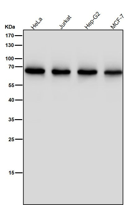Anti-ENT2 Rabbit Monoclonal Antibody Boster Bio