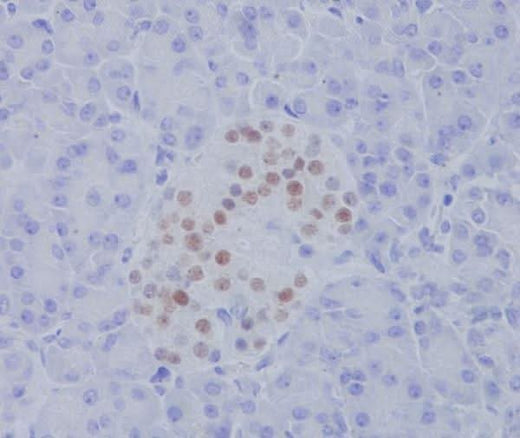 Anti-NKX2.2 Rabbit Monoclonal Antibody Boster Bio