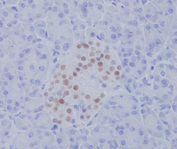 Anti-NKX2.2 Rabbit Monoclonal Antibody Boster Bio