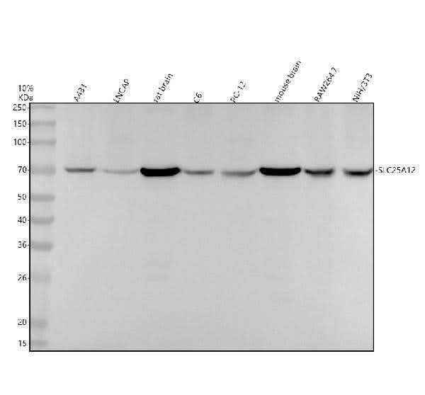 Anti-SLC25A12 Rabbit Monoclonal Antibody Boster Bio