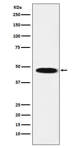 Anti-GABA A Receptor beta 1 Rabbit Monoclonal Antibody Boster Bio