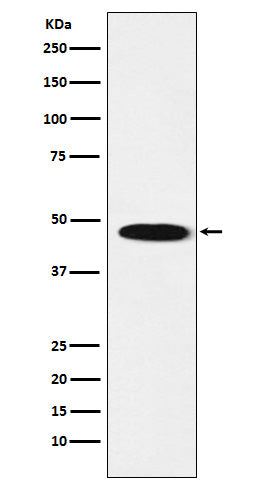 Anti-GABA A Receptor beta 1 Rabbit Monoclonal Antibody Boster Bio