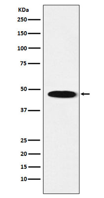Anti-GABA A Receptor beta 1 Rabbit Monoclonal Antibody Boster Bio