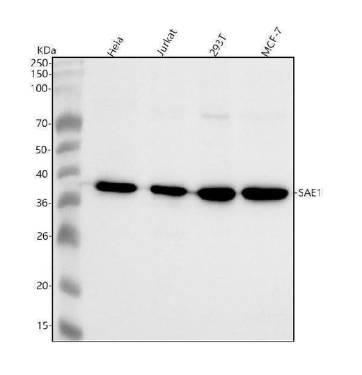 Anti-SAE1 Rabbit Monoclonal Antibody Boster Bio