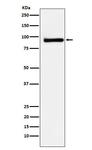 Anti-KAISO Rabbit Monoclonal Antibody Boster Bio